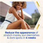 Nivea Luminous630 Anti-Marks & Spots Body Cream 200ml