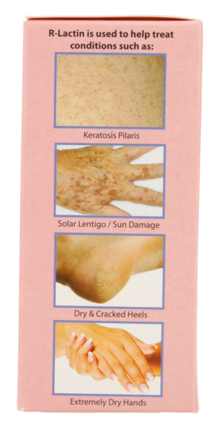 R-lactin Lactic Acid Lotion 10% 250ml